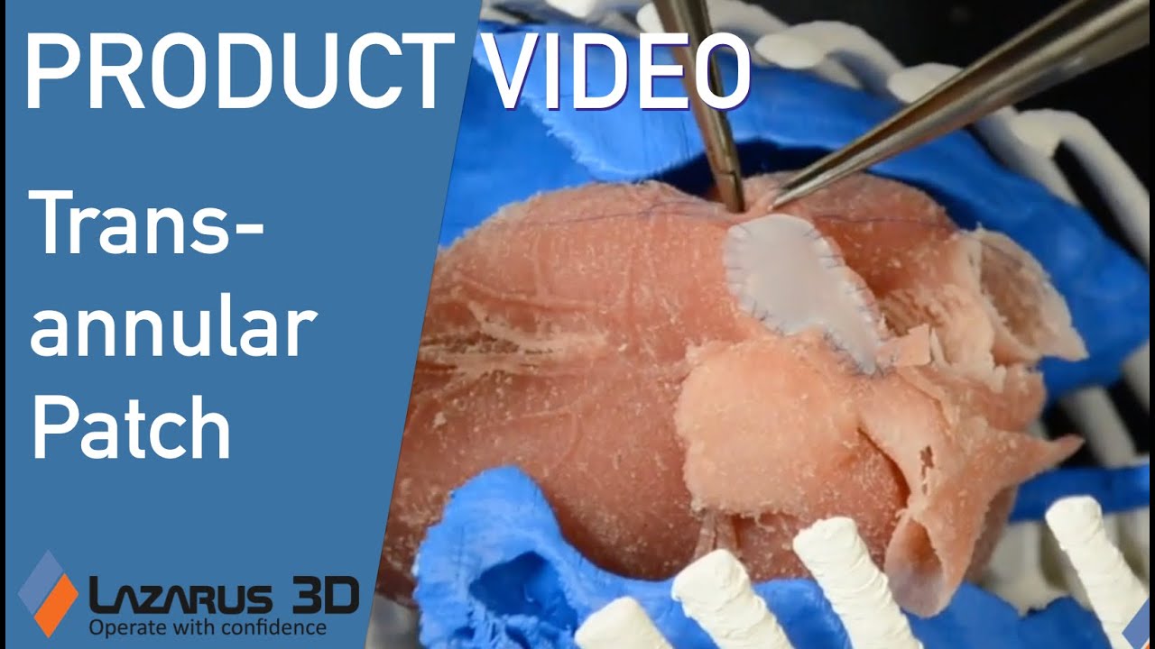 Valve-Sparing Surgery for Tetralogy of Fallot Simulation