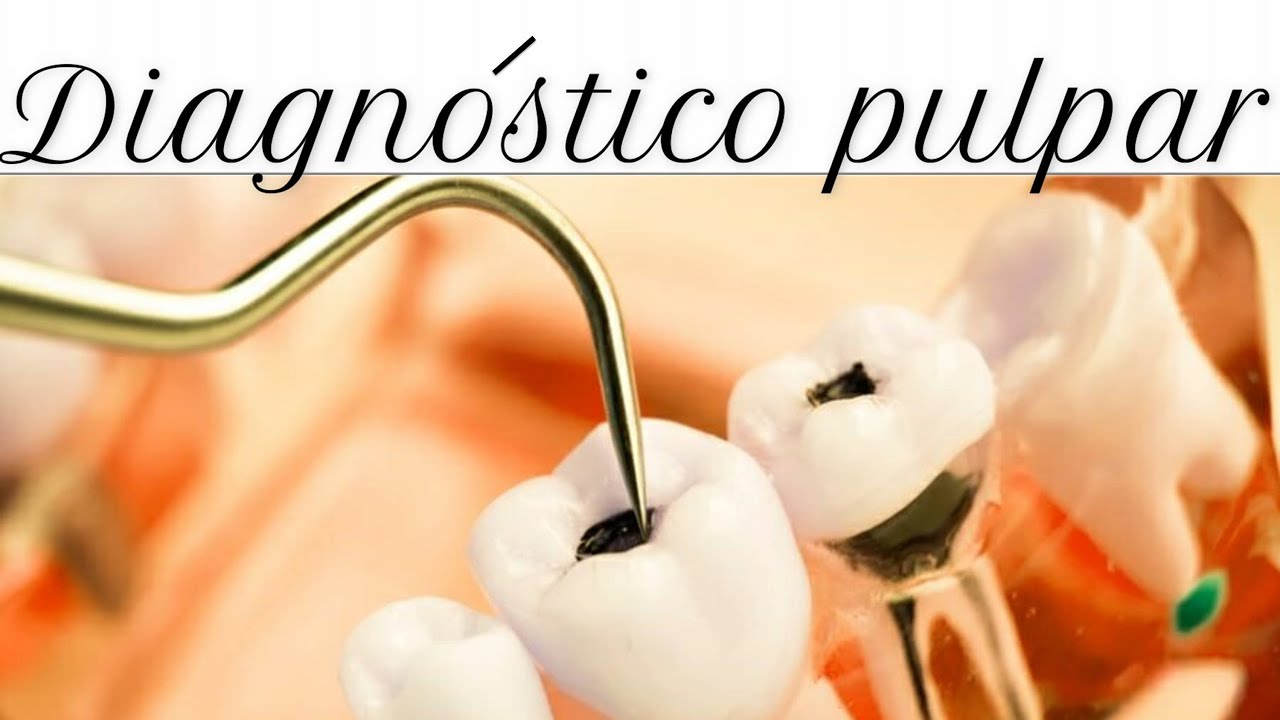 🩺Diagnóstico de ENFERMEDADES PULPARES🦷 Estudiar Odontología