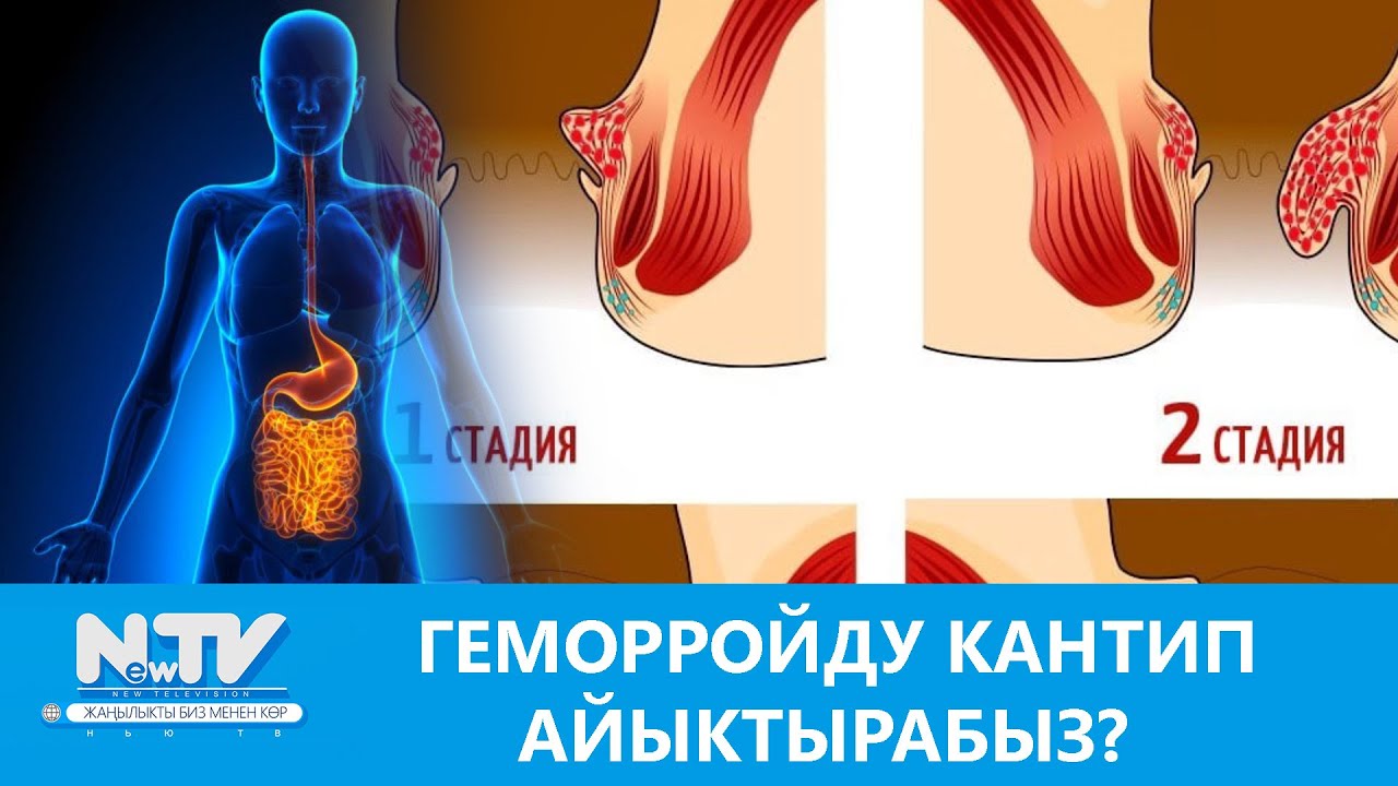 NewTV// ГЕМОРРОЙДУ КАНТИП АЙЫКТЫРАБЫЗ? // ДАБАГЕР