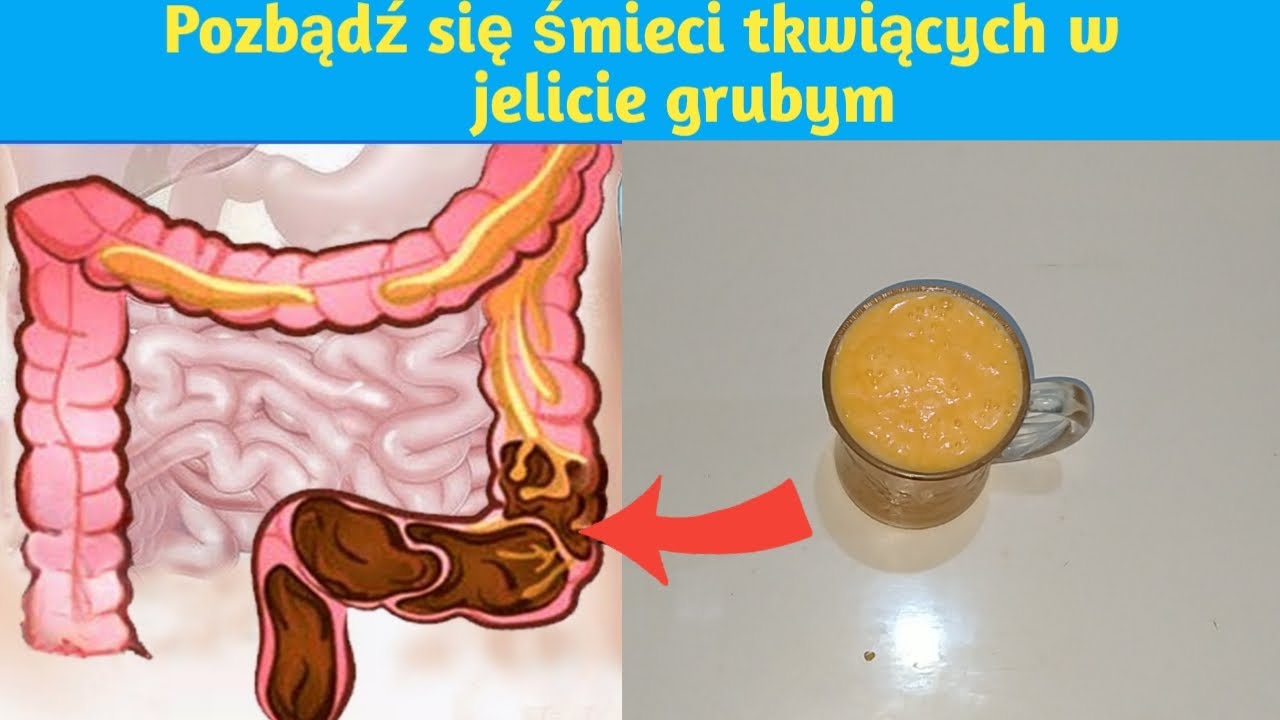 Pozbądź się śmieci tkwiących w okrężnicy w zaledwie 3 dni