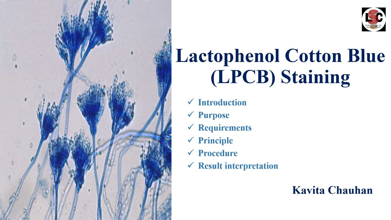 Lactophenol Cotton Blue (LPCB) Staining | In Hindi