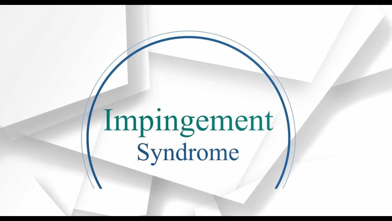 Impingement Syndrome - Symptoms, evaluation, and treatment.
