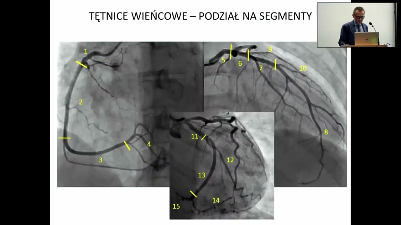 Podstawy opisu koronarografii i pozostałych badań z zakresu kardiologii inwazyjnej