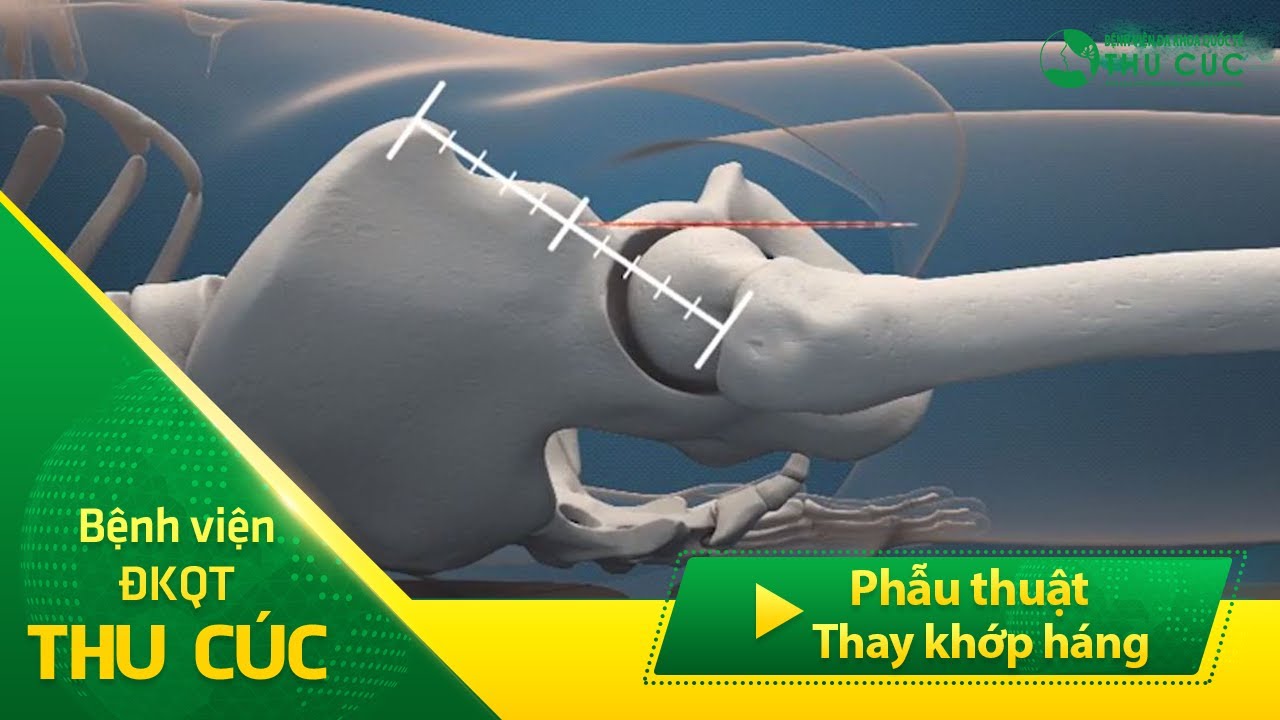 Phẫu thuật 