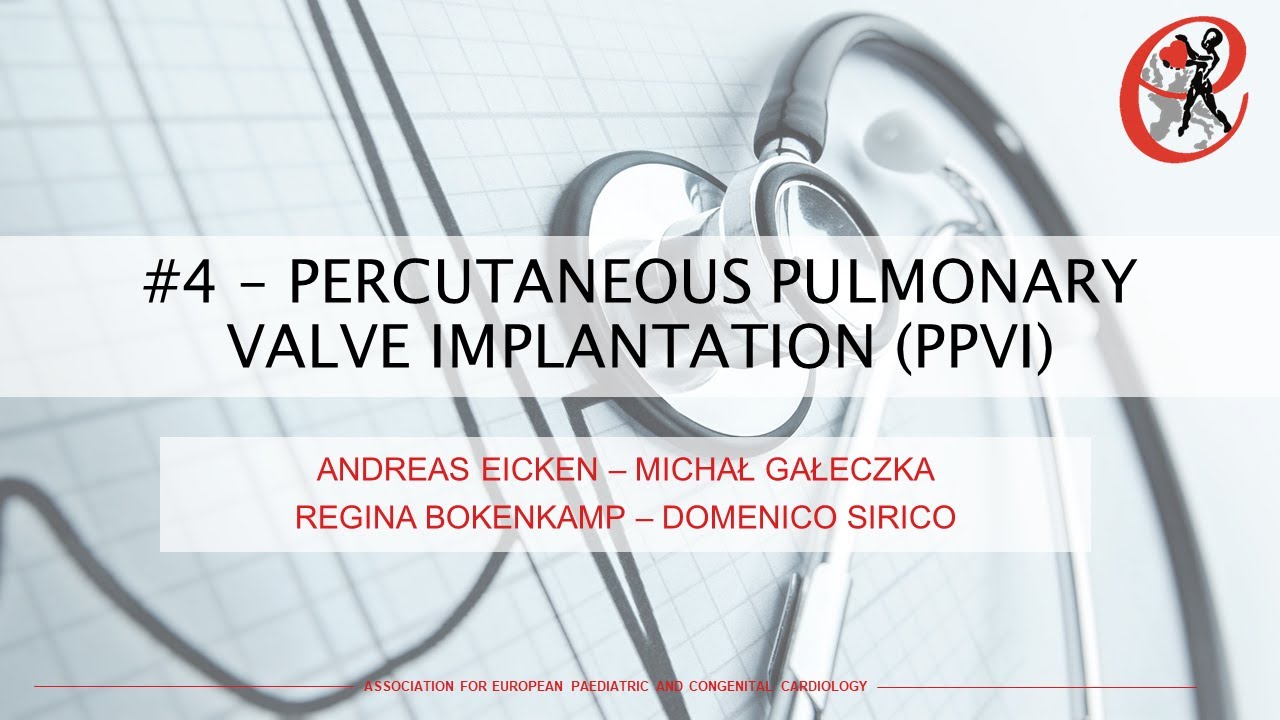 Interventional cardiology - Percutaneous pulmonary valve implantation