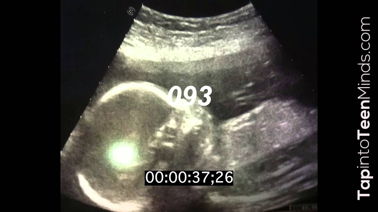 Baby Beats - 3 Act Math Task - Act 3 - Proportional Reasoning & Rates of Change