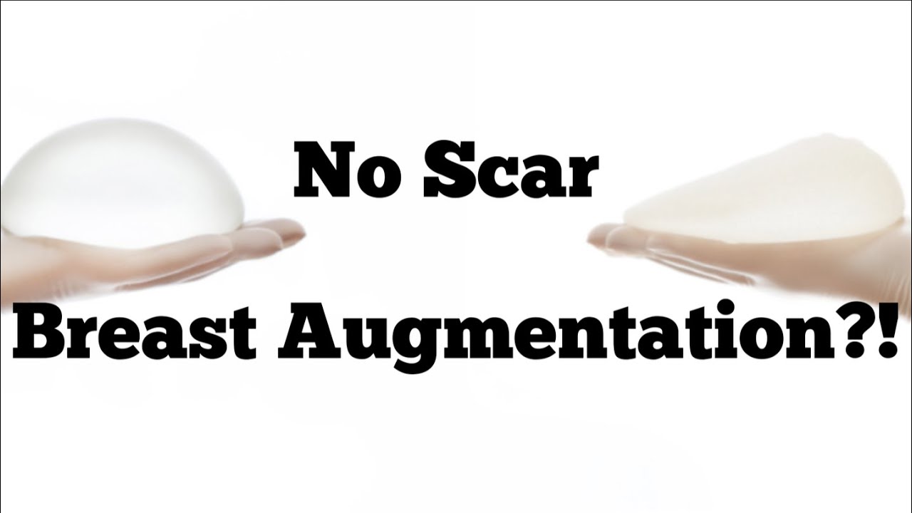 No Scar Breast Augmentation?!