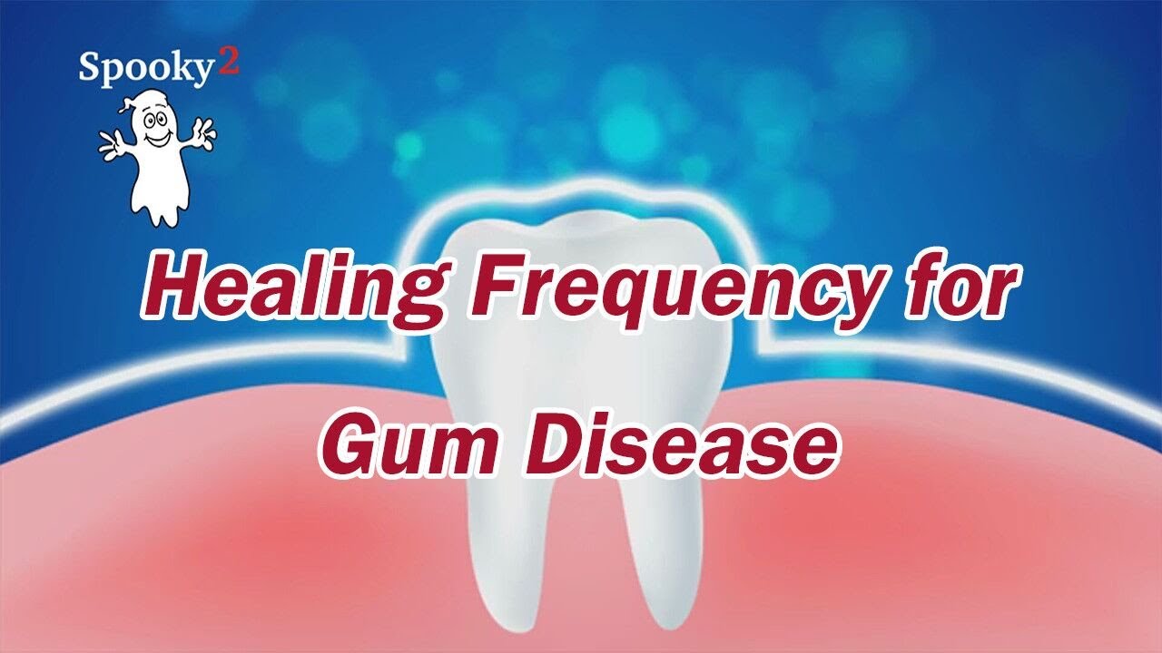 Healing Frequency for Gum Disease | Periodontitis - Spooky2 Rife Frequencies
