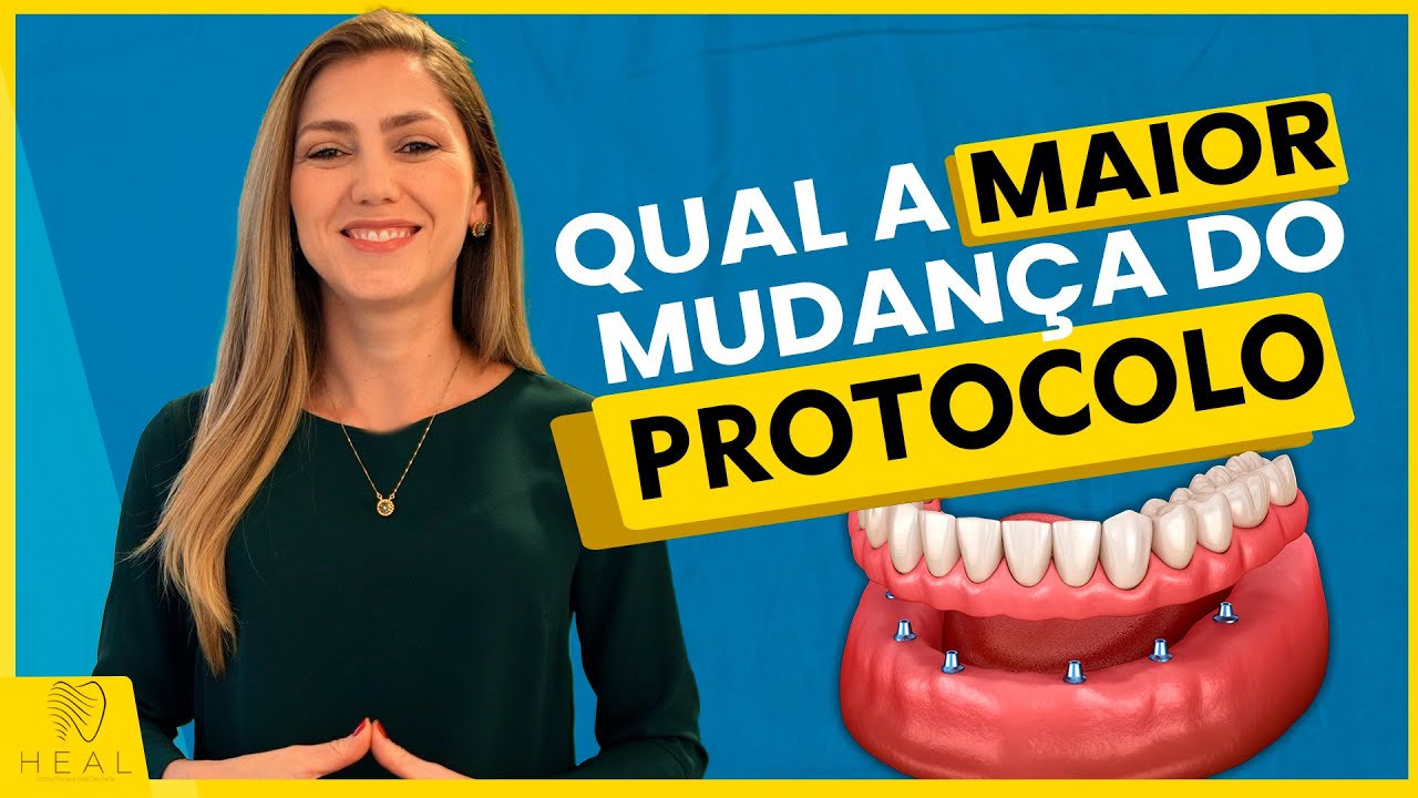 O que vai acontecer com você depois que colocar a Prótese Protocolo?
