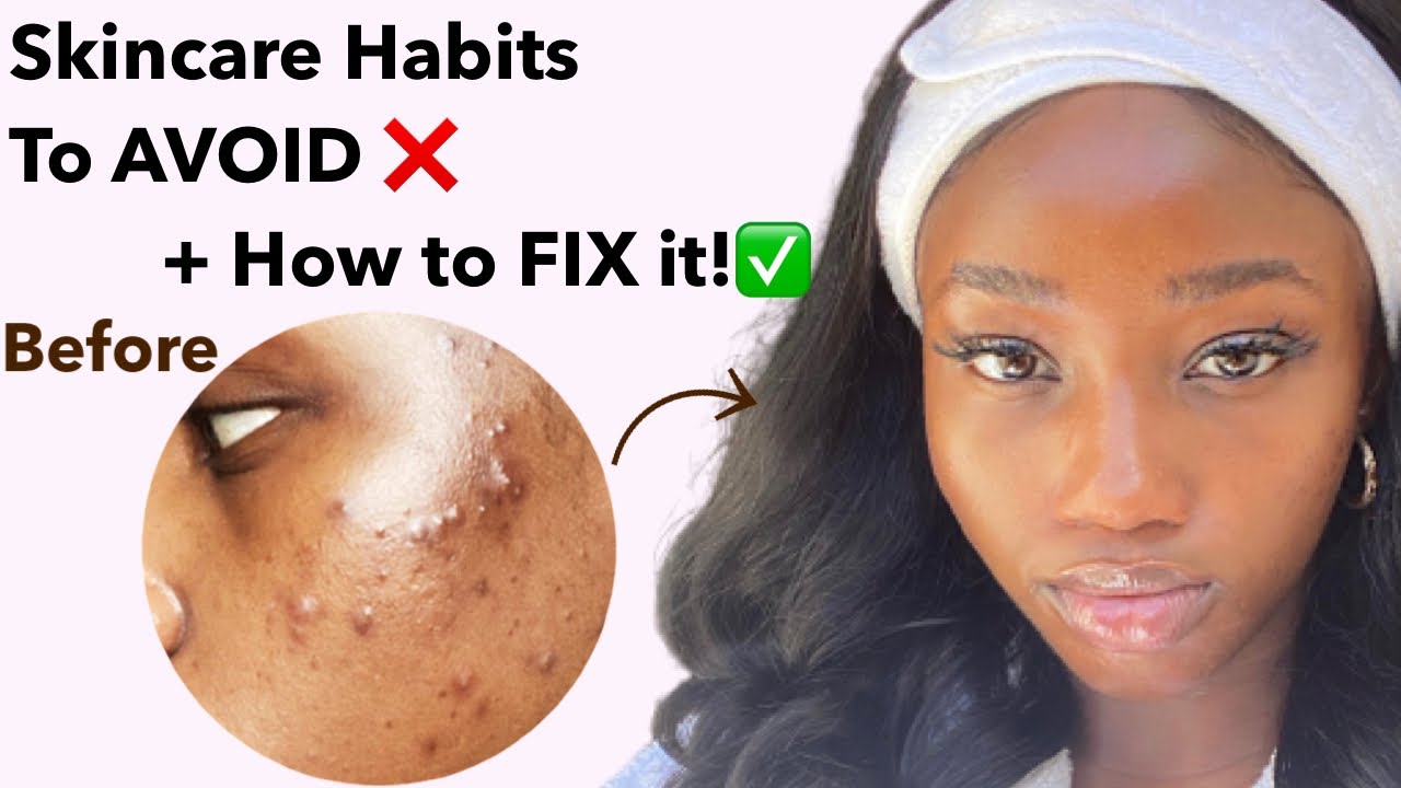 How I DAMAGED my skin barrier!!! + HOW I FIXED IT FAST| REPAIR MOISTURE BARRIER | Retin A