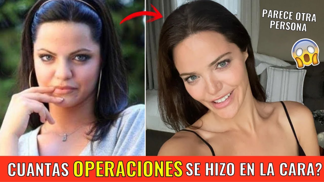 Transformación de Hilal Altınbilek: Descubre Todas sus Operaciones Estéticas en Detalle 💉🌟