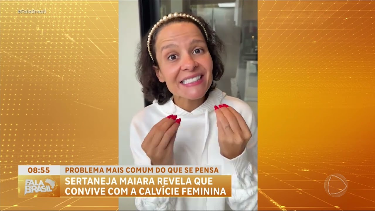 Alopecia androgenética: saiba mais sobre a doença que afeta a cantora Maiara, da dupla com Maraisa