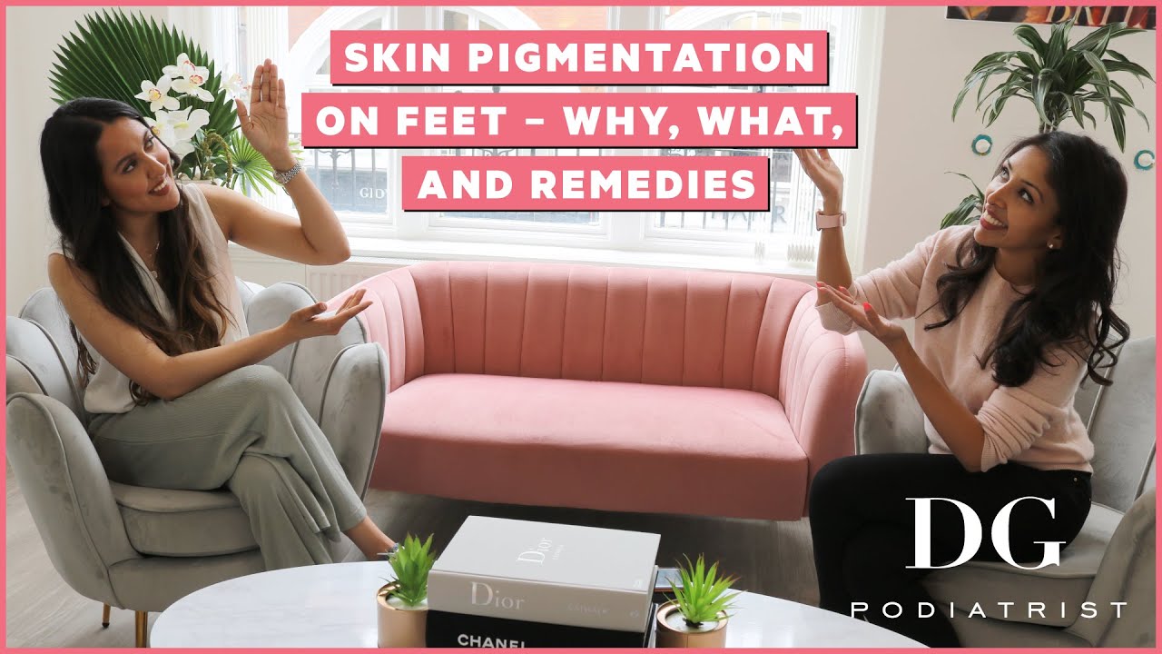 Dark circles on toes and skin pigmentation | @vanitarattan