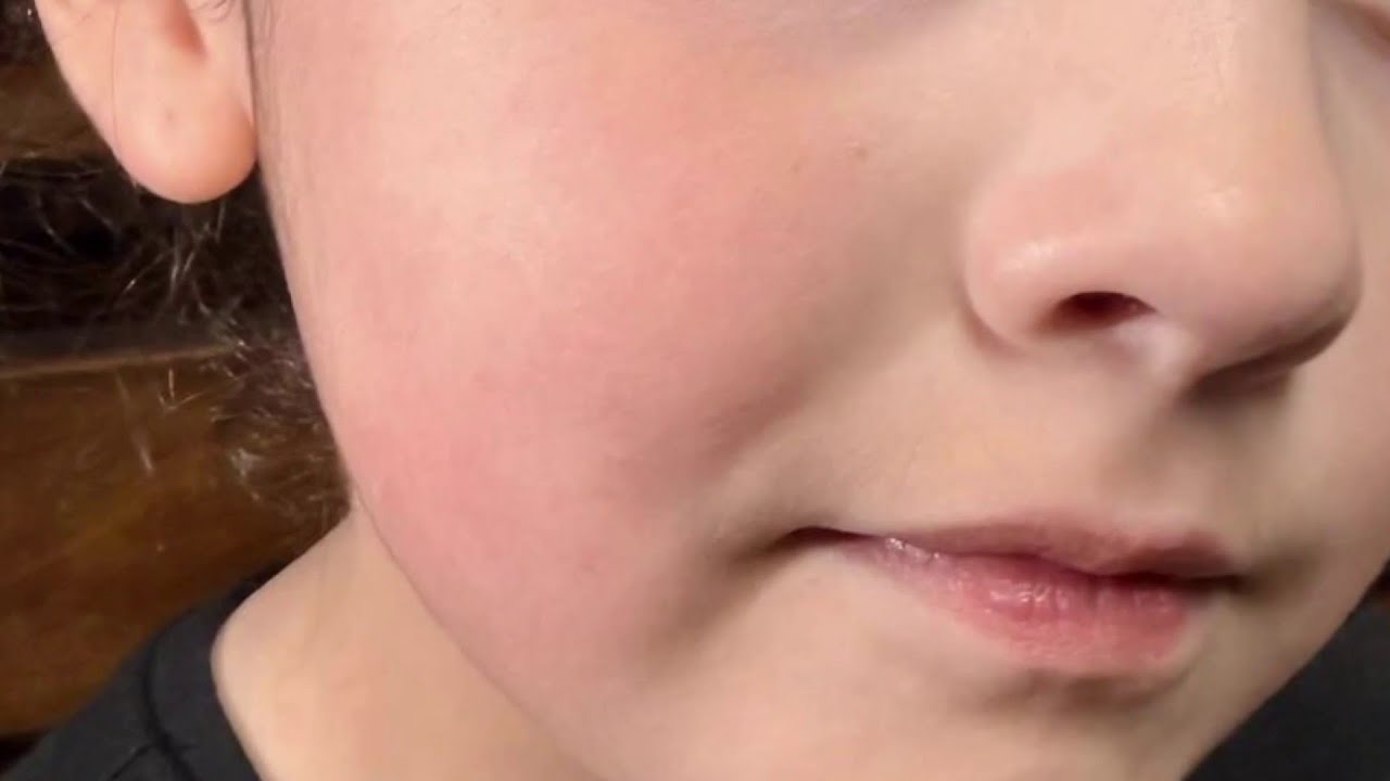 'Messed with the wrong momma': Mother outraged after 4-year-old girl slapped by teacher