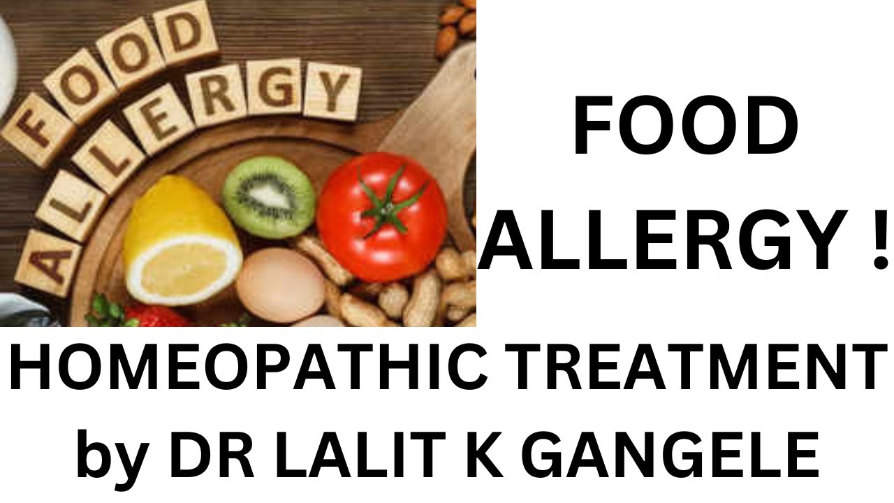 food allergy || homeopathic medicine for food allergy || homeopathic treatment for food allergies !