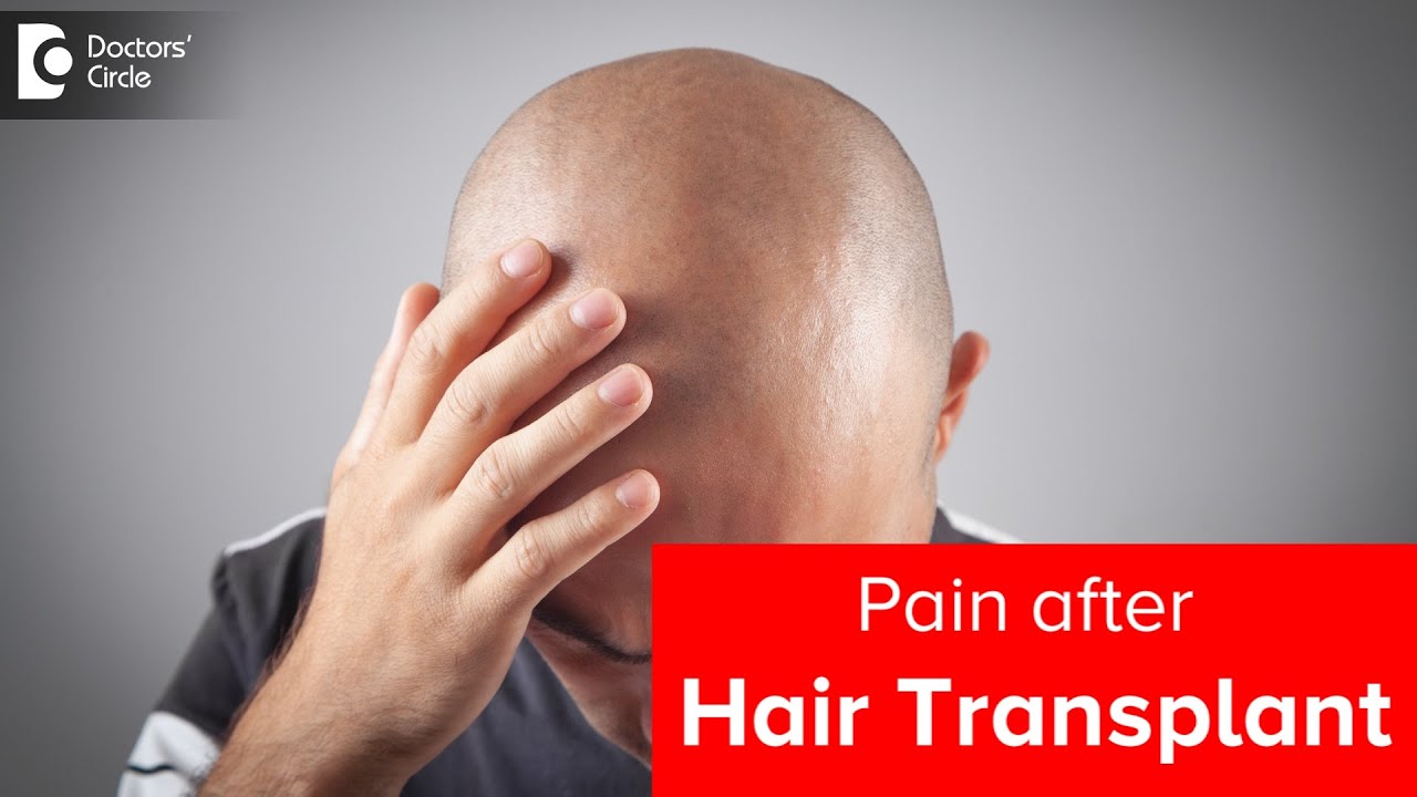 How long will pain persist after HAIR TRANSPLANT? KNOW MORE - Dr. Deepak P Devakar | Doctors' Circle