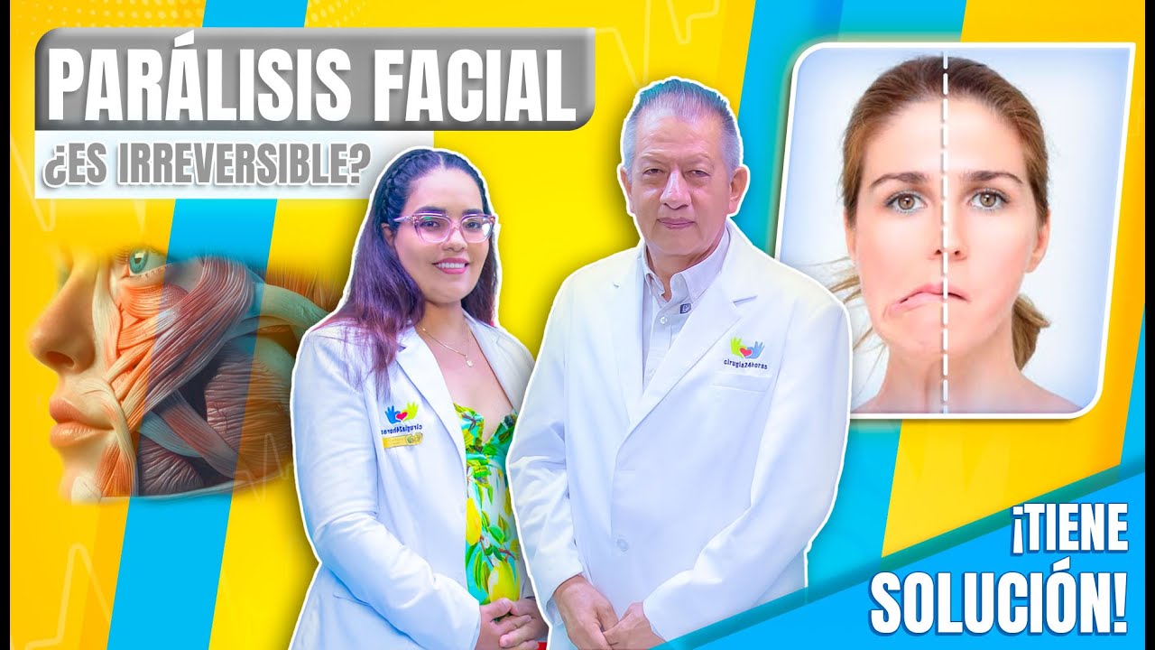 Parálisis Facial 🔴 ¡Atención! esto debes saber antes de que sea tarde