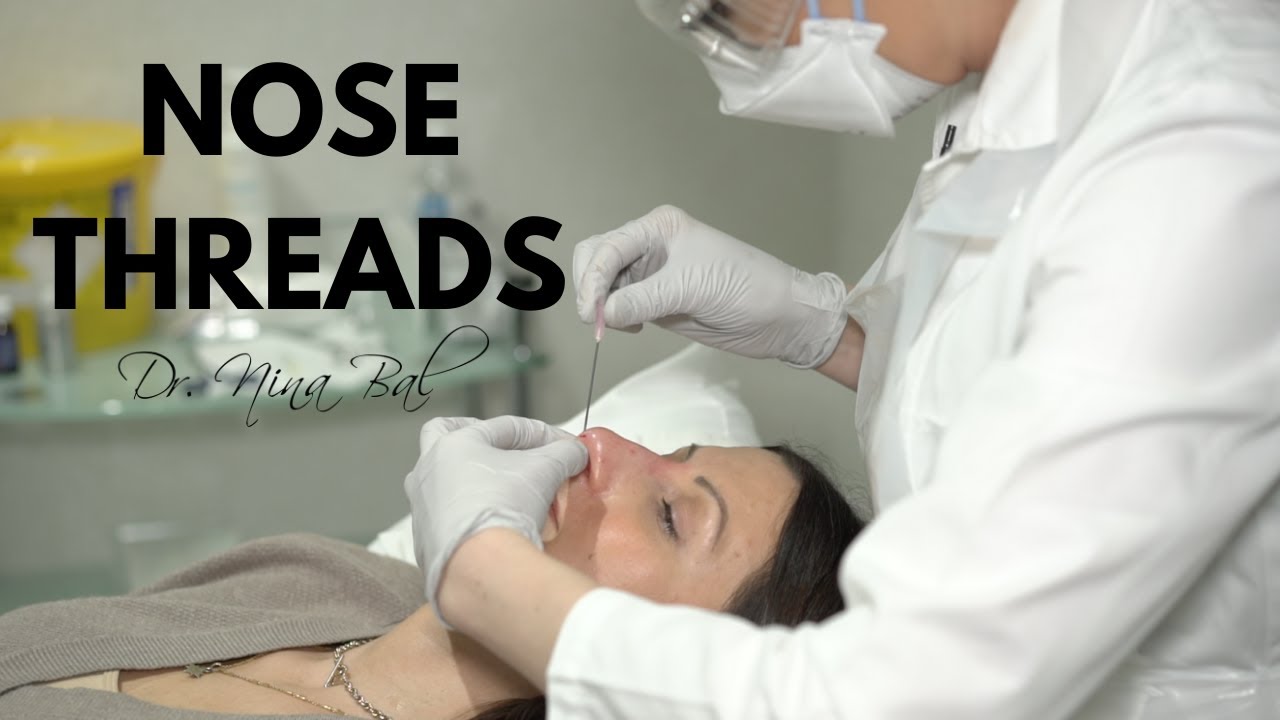 Nose Thread Lift Before And After 💕 Nose Thread Lift Procedure by Dr Nina Bal