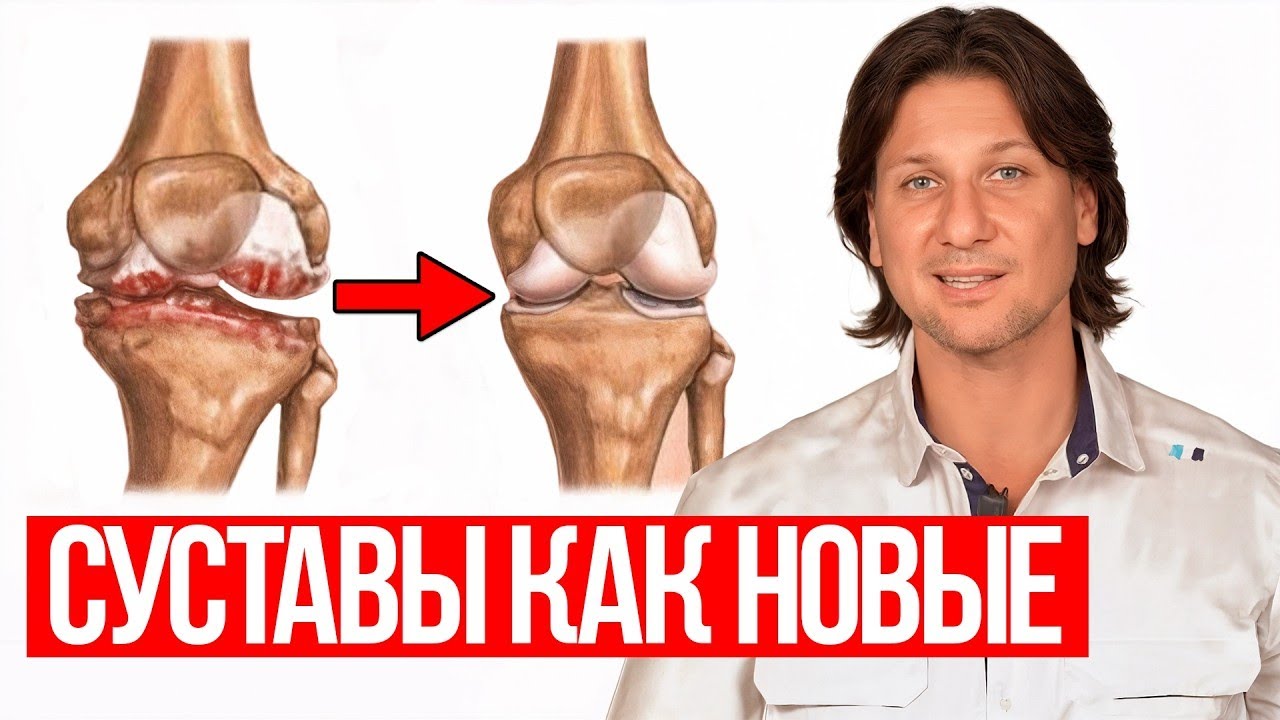Артроз не приговор! Как восстановить суставы без операции и лекарств?