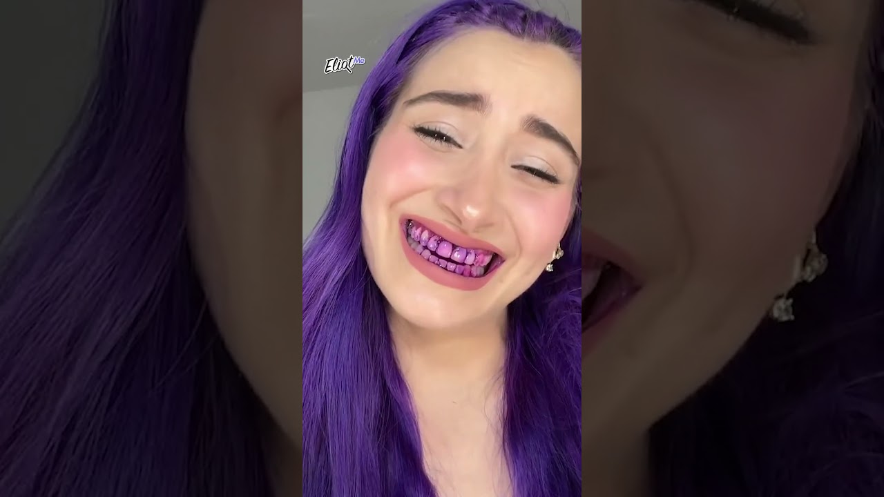 COSAS MORADAS M&Aacute;S RANDOM QUE TIENE ALE R&Iacute;OS: TORTILLAS, DIENTES Y M&Aacute;S #shorts