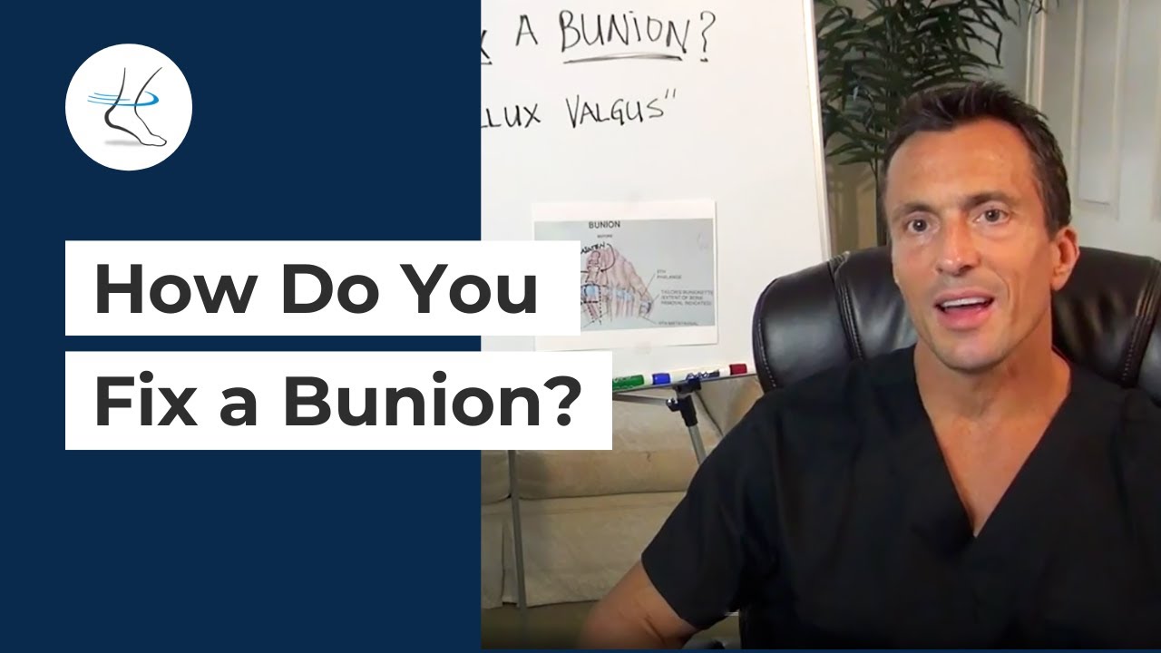 How Do You Fix a Bunion? | Ask Dr. Moore