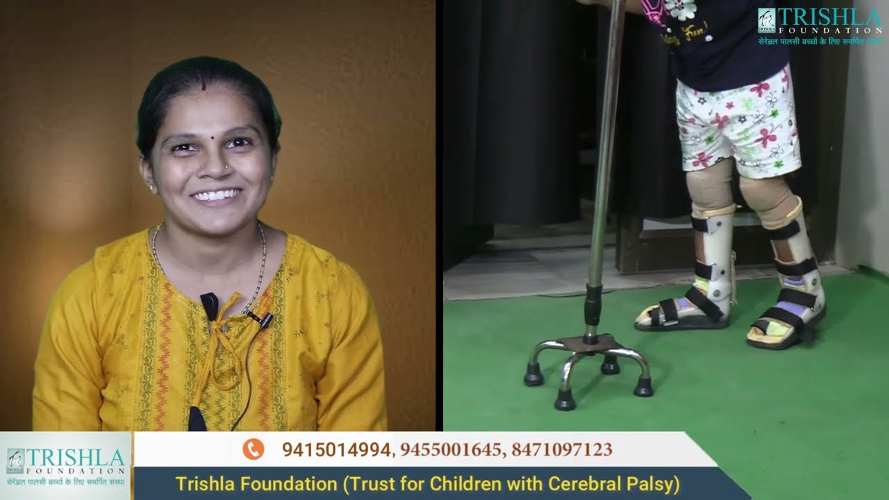 Diplegic Spastic Cerebral Palsy with Severe Foot & knee Deformity Treatment | Trishla Foundation
