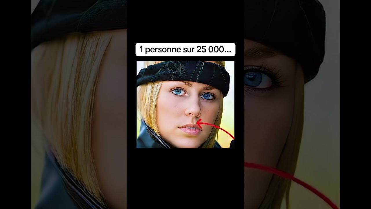 Les traits g&eacute;n&eacute;tiques humains les plus rares 😳￼