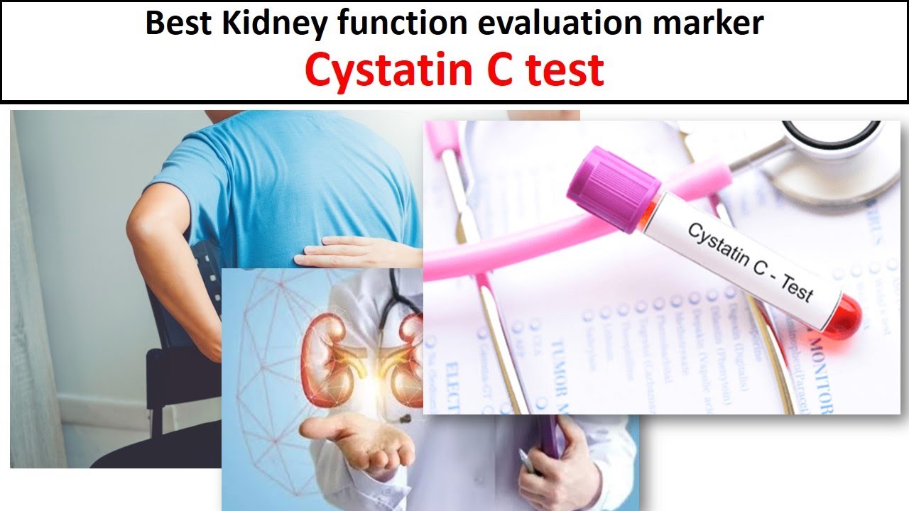 Cystatin C test-Best Kidney function evaluation marker.#CystatinC#Medilabacademy#Kidneyfunction