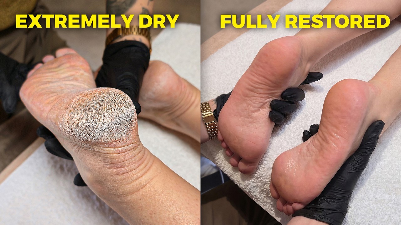 My New Secret Weapon That Restores Severely Dry Heels