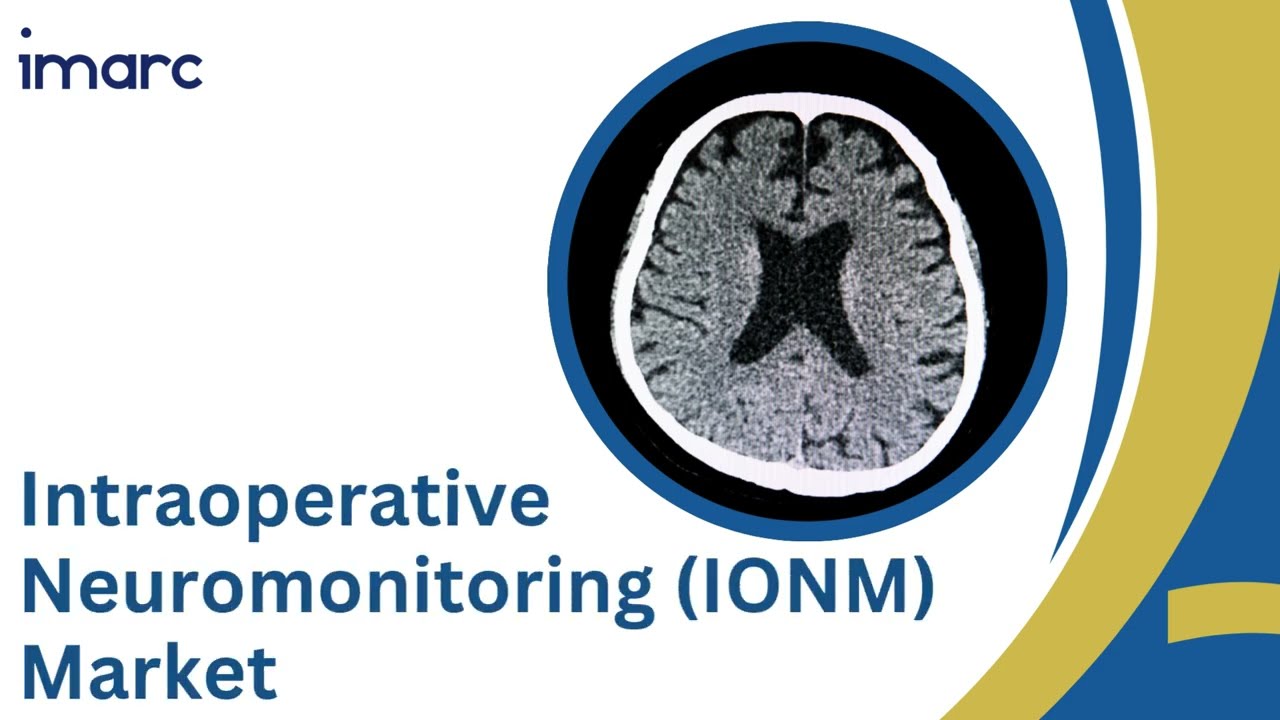 Intraoperative Neuromonitoring (IONM) Market: Enhancing Surgical Precision and Patient Safety 🧠🏥