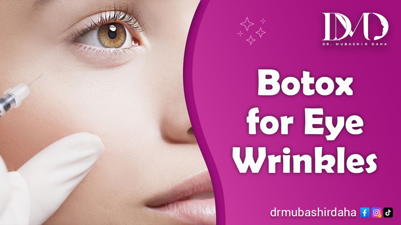Botox for Eye Wrinkles | Dr. Mubashir Daha | Best Skin Specialist | Best Dermatologist Islamabad