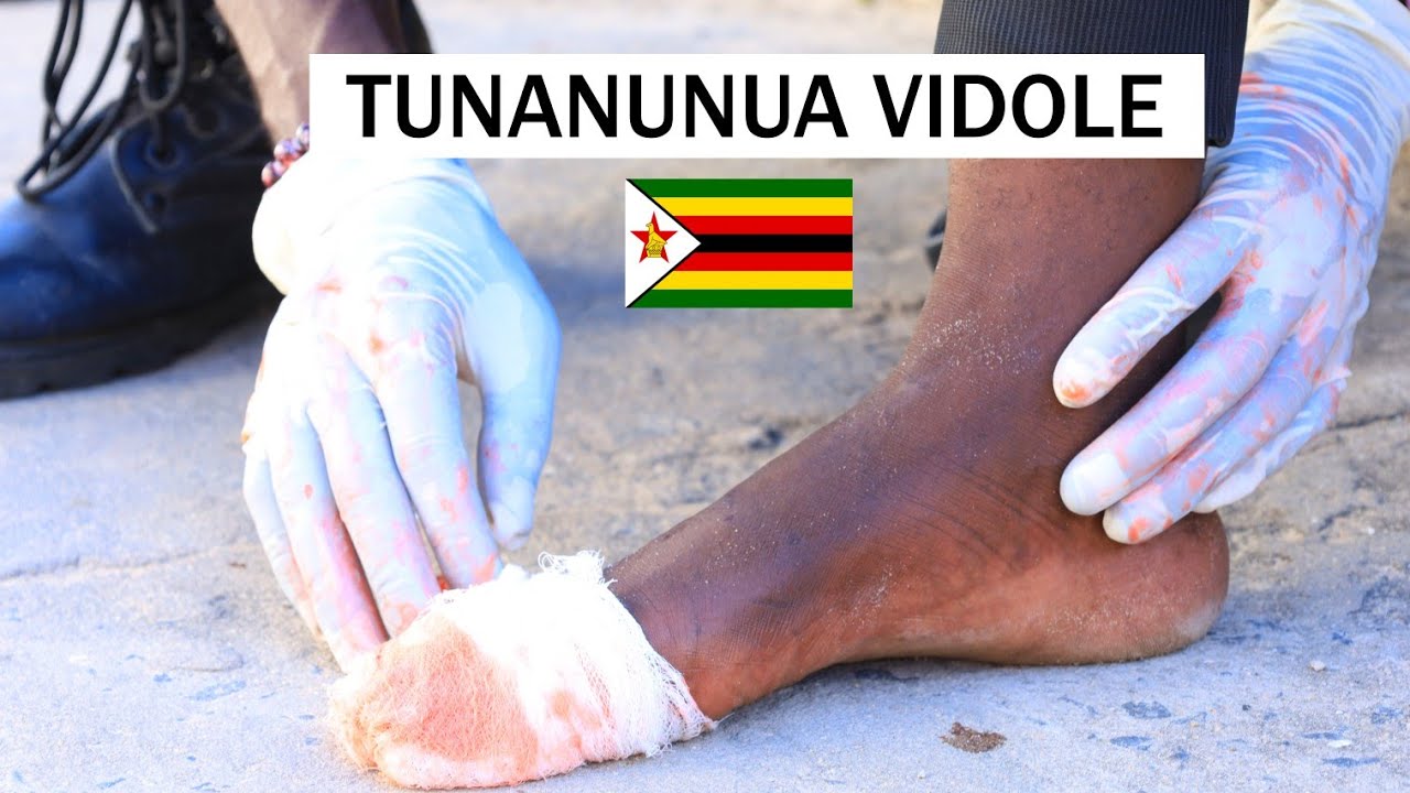 TUNANUNUA VIDOLE  WAMEFIKA BONGO