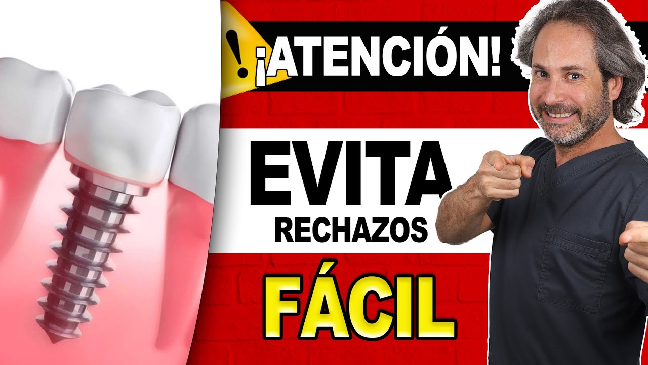 ⛔ERRORES COMUNES durante el proceso de Colocación de 𝗜𝗺𝗽𝗹𝗮𝗻𝘁𝗲𝘀 𝗗𝗲𝗻𝘁𝗮𝗹𝗲𝘀 paso a paso EXPLICADOS