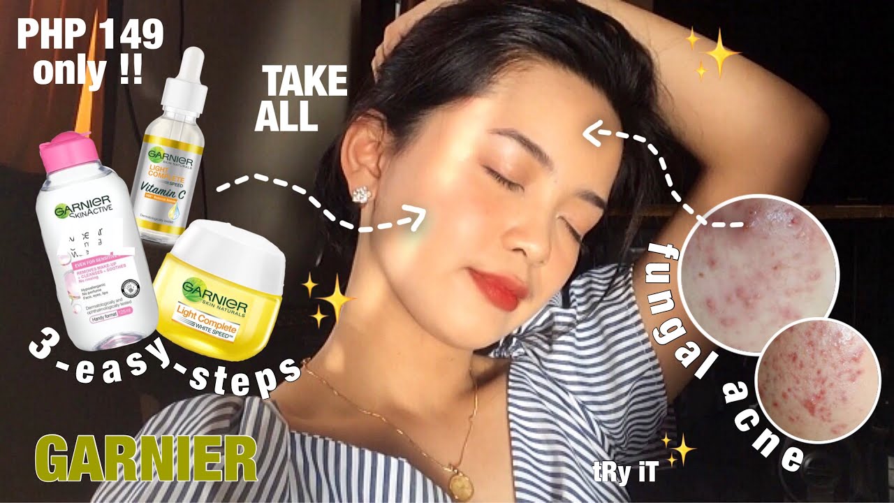 PHP 149‼️ 3 EASY STEPS! Teenage Affordable Skincare Routine Ft. Garnier ✨ | Shynne B