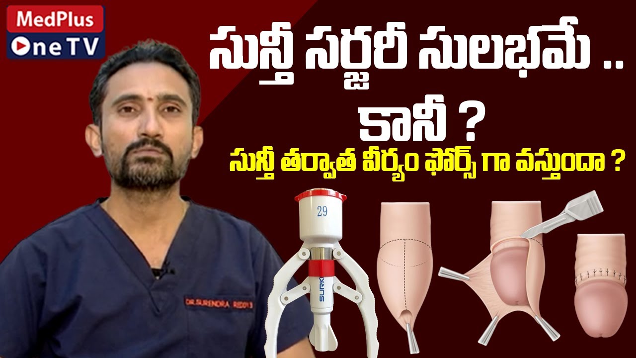 Stapler Circumcision Facts : Know about Stapler Circumcision Surgery | @MedPlus ONE TV
