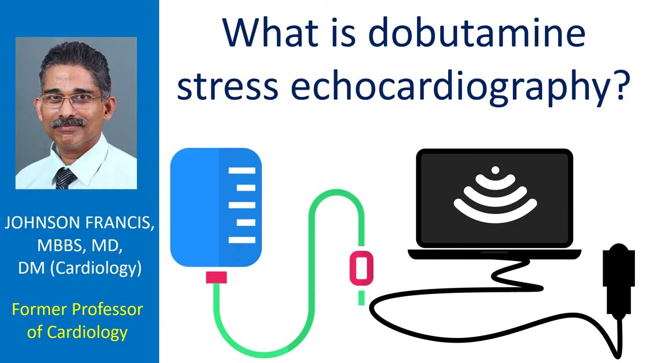 What is dobutamine stress echocardiography?