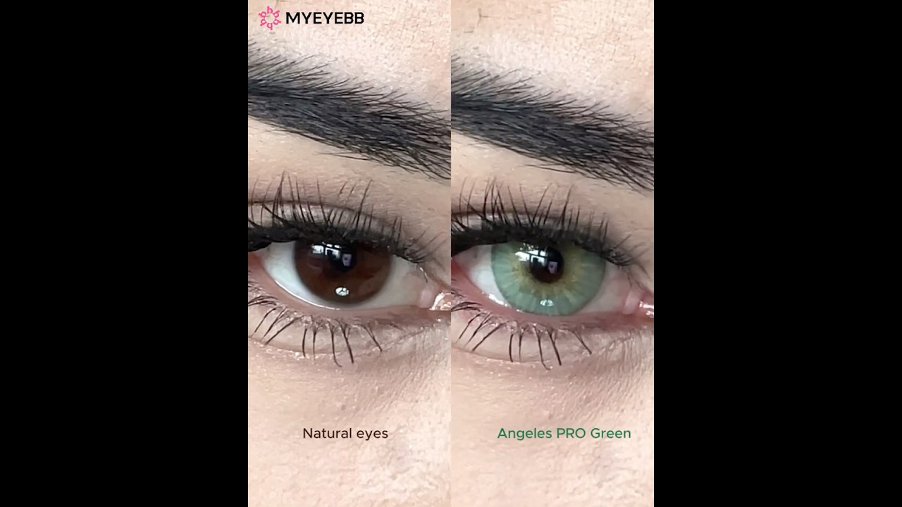 This Look Passes the Real-Eye Test 👁️✅丨1 Year 