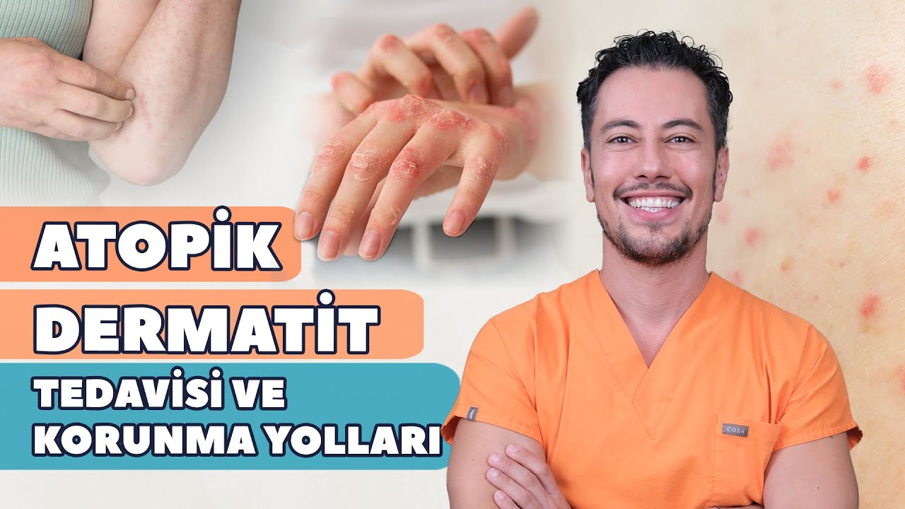 Atopik Dermatit Tedavisi ve Korunma Yolları
