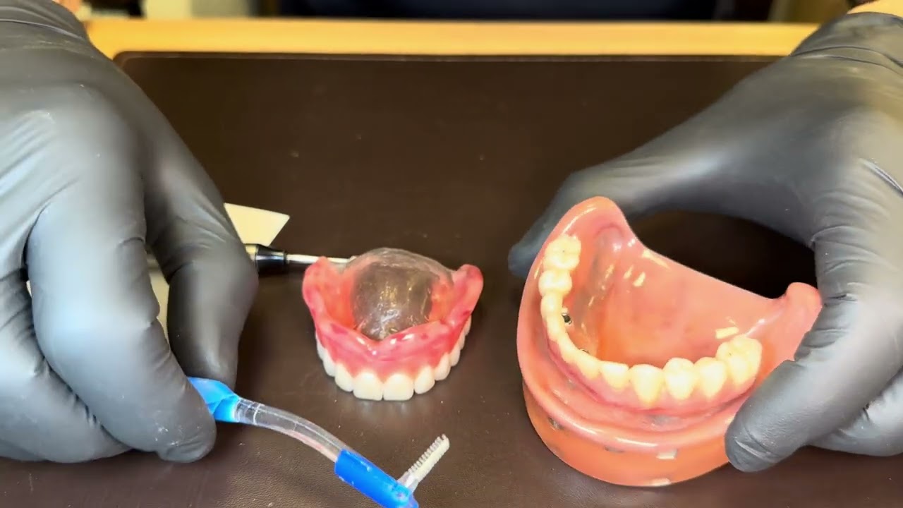 Diferen&ccedil;a entre pr&oacute;tese fixa e dentadura!