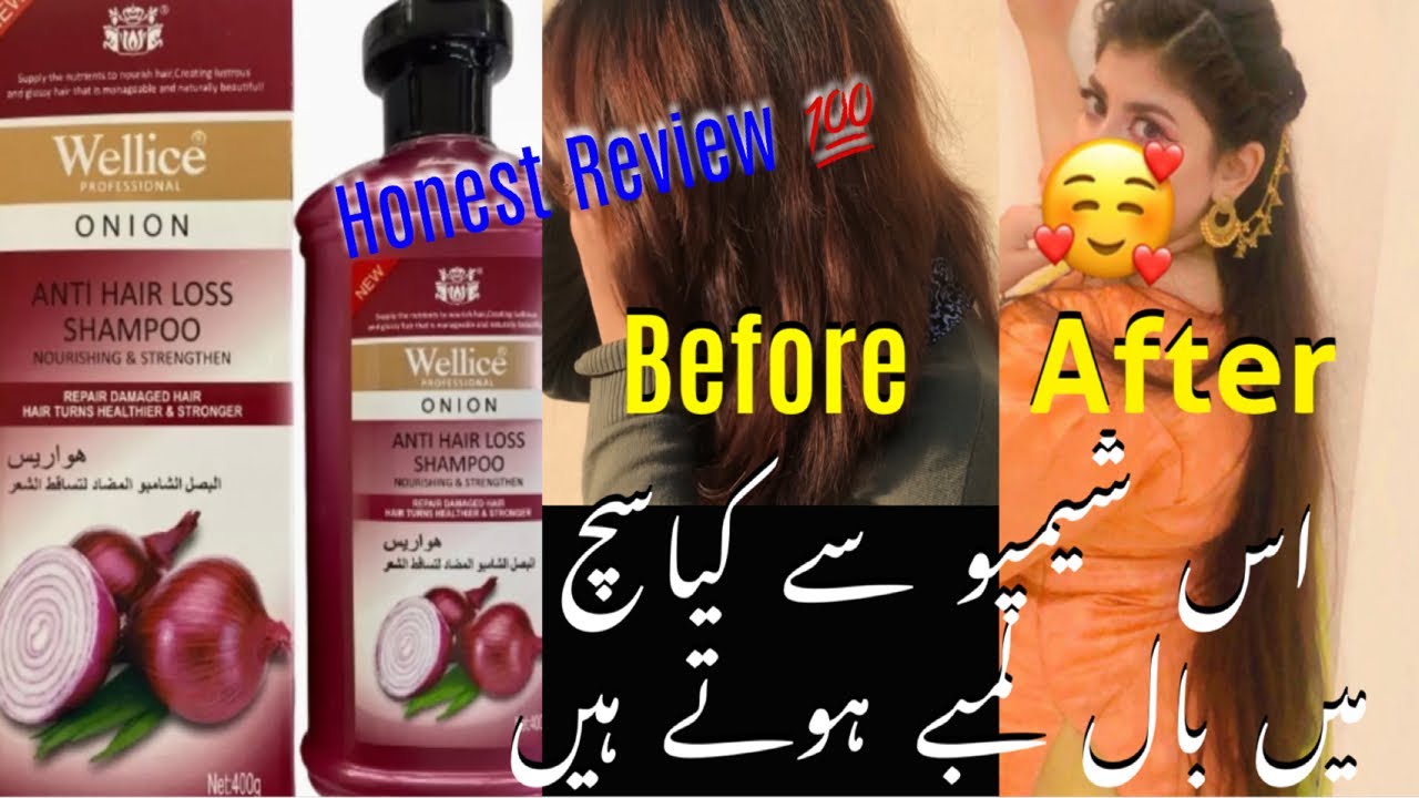 Wellice Onion Anti Hair Loss Shampoo || Onion Shampoo || Honest Review / Worth Buying Or Not