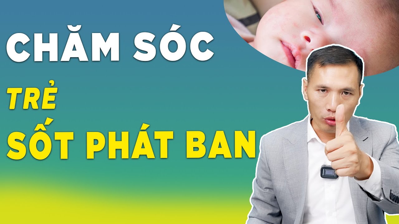 Cách chăm sóc trẻ phát ban sau sốt ngay tại nhà - Dấu hiệu cần cho bé đi khám ngay