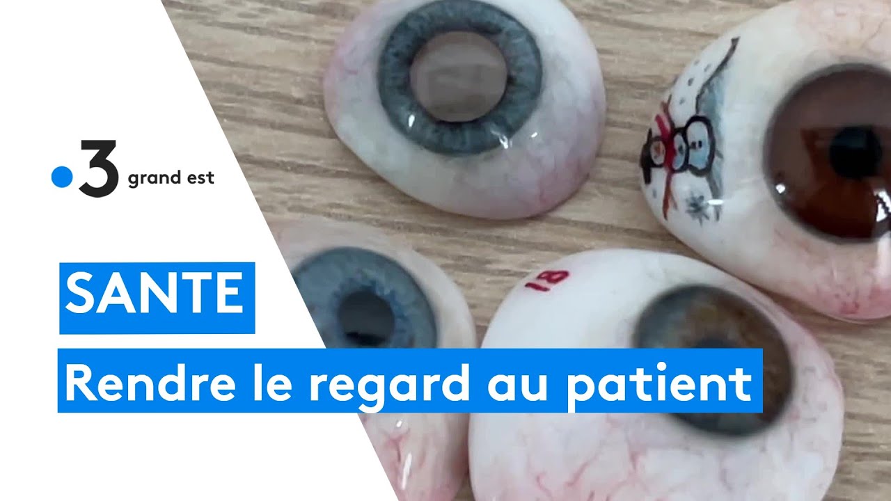 Une oculariste fabrique des prothèses pour des patients ayant perdu un œil