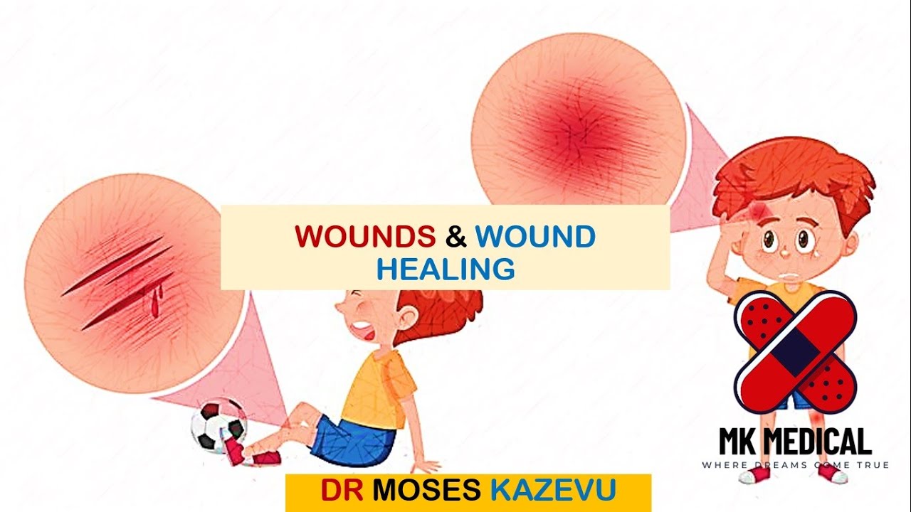 Wounds & Wound healing