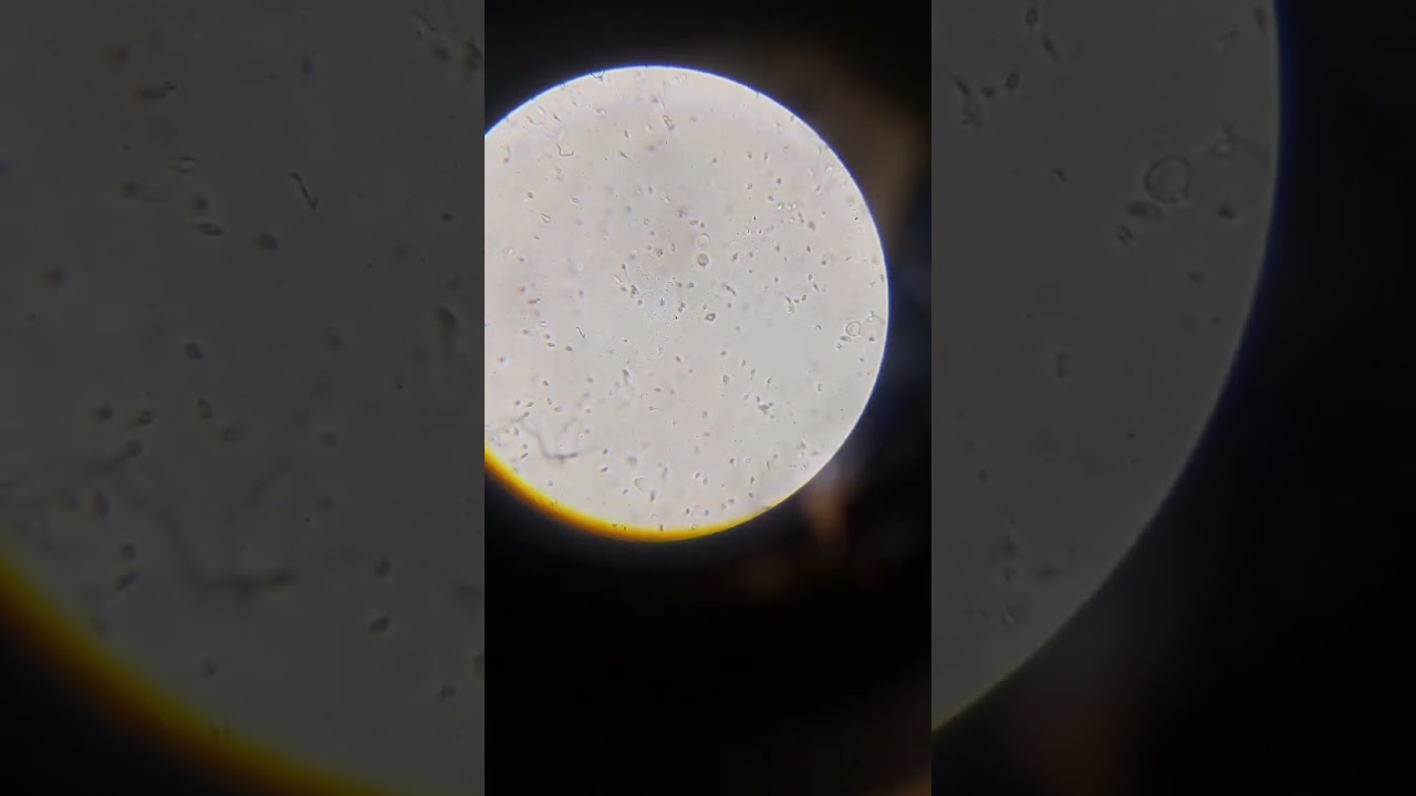 #science #lab #labreport #labtest #labtestreport #microscope #labtested
