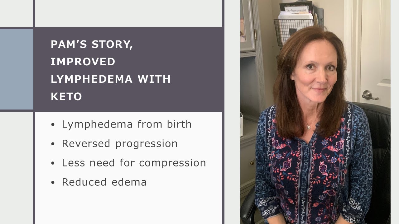 Can Keto help with primary Lymphedema? - Pam's story