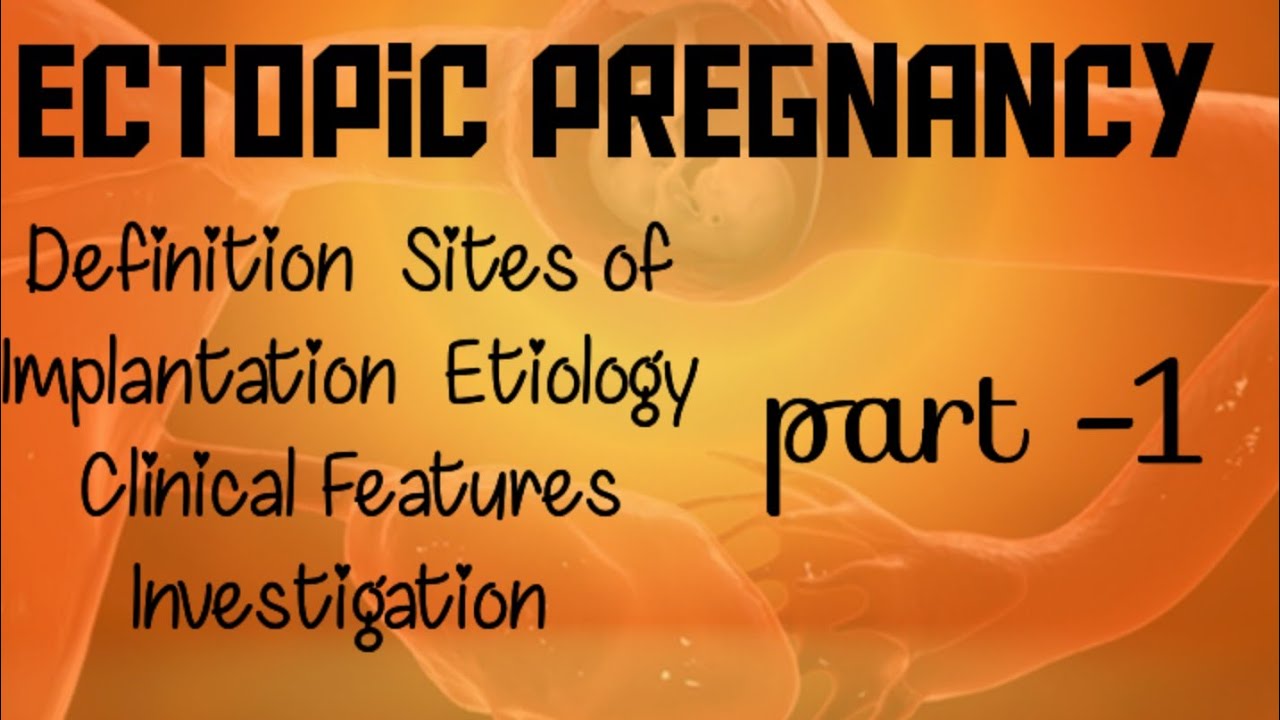 Ectopic Pregnancy || Sites of Implantation