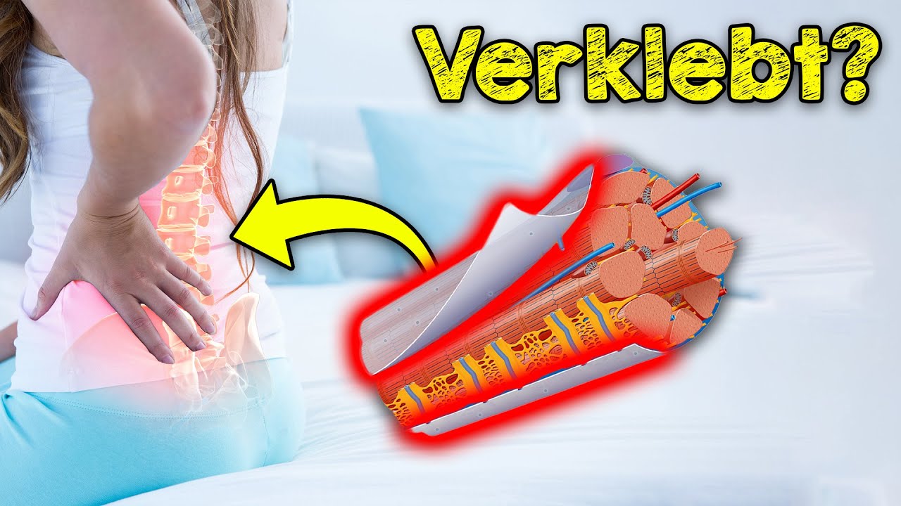 Mythos verklebte Faszien: Hype oder Tatsache? Was es mit den Faszien auf sich hat.