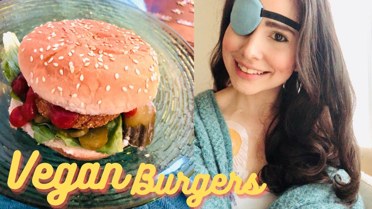 I Have To Wear An Eye Patch + Making Vegan Burgers 🍔 | Love Hard Fight Hard ♡