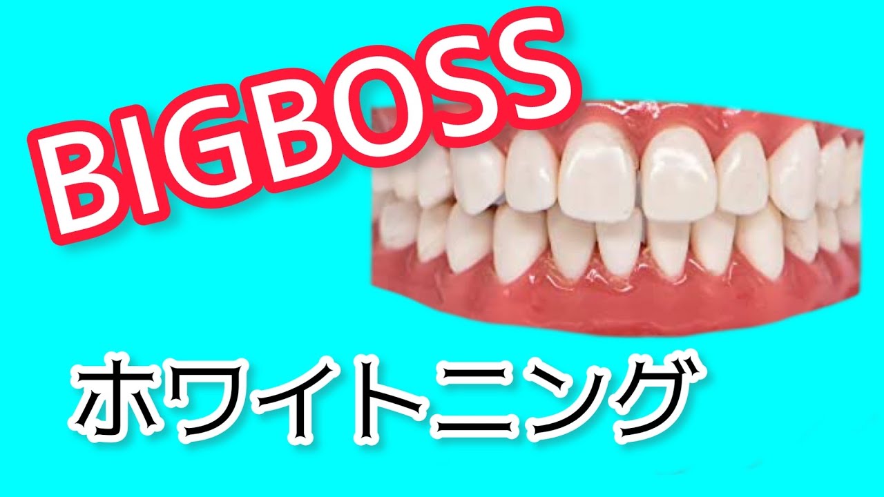 歯が白くなりたい！マー君改造#ホワイトニング #新庄剛志 #白い歯#ホームホワイトニング