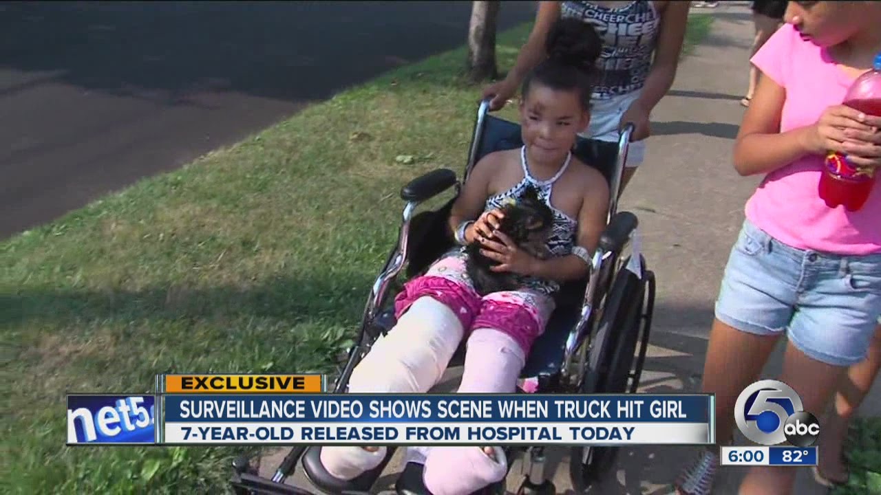 Cleveland girl who got hit by a car on West 58th St home from the hospital